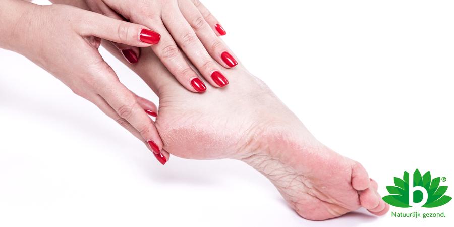 Alles wat je moet weten over hielkloven: Oorzaken, Preventie en Behandeling