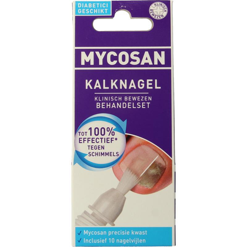 Kalknagel behandelset