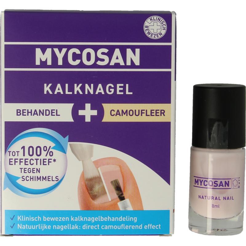 Kalknagel behandel & camoufleer