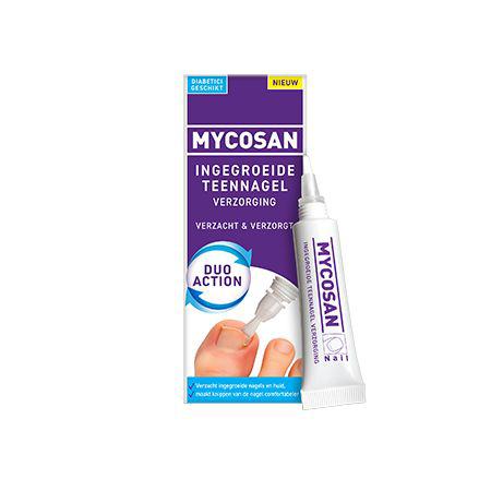 Ingegroeide teennagel verzorging