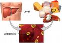 Wat is cholesterol? Hoe hou ik het onder controle?