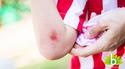 Onderzoek: Meer kinderen gewond in de zomer