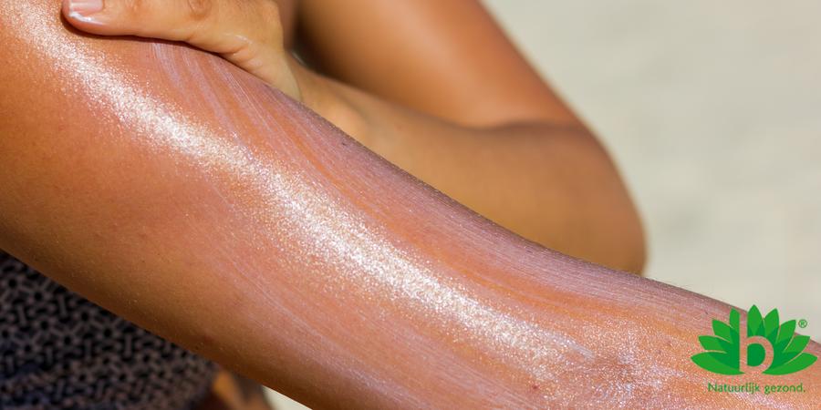 Zonneallergie: zo pak je de symptomen aan
